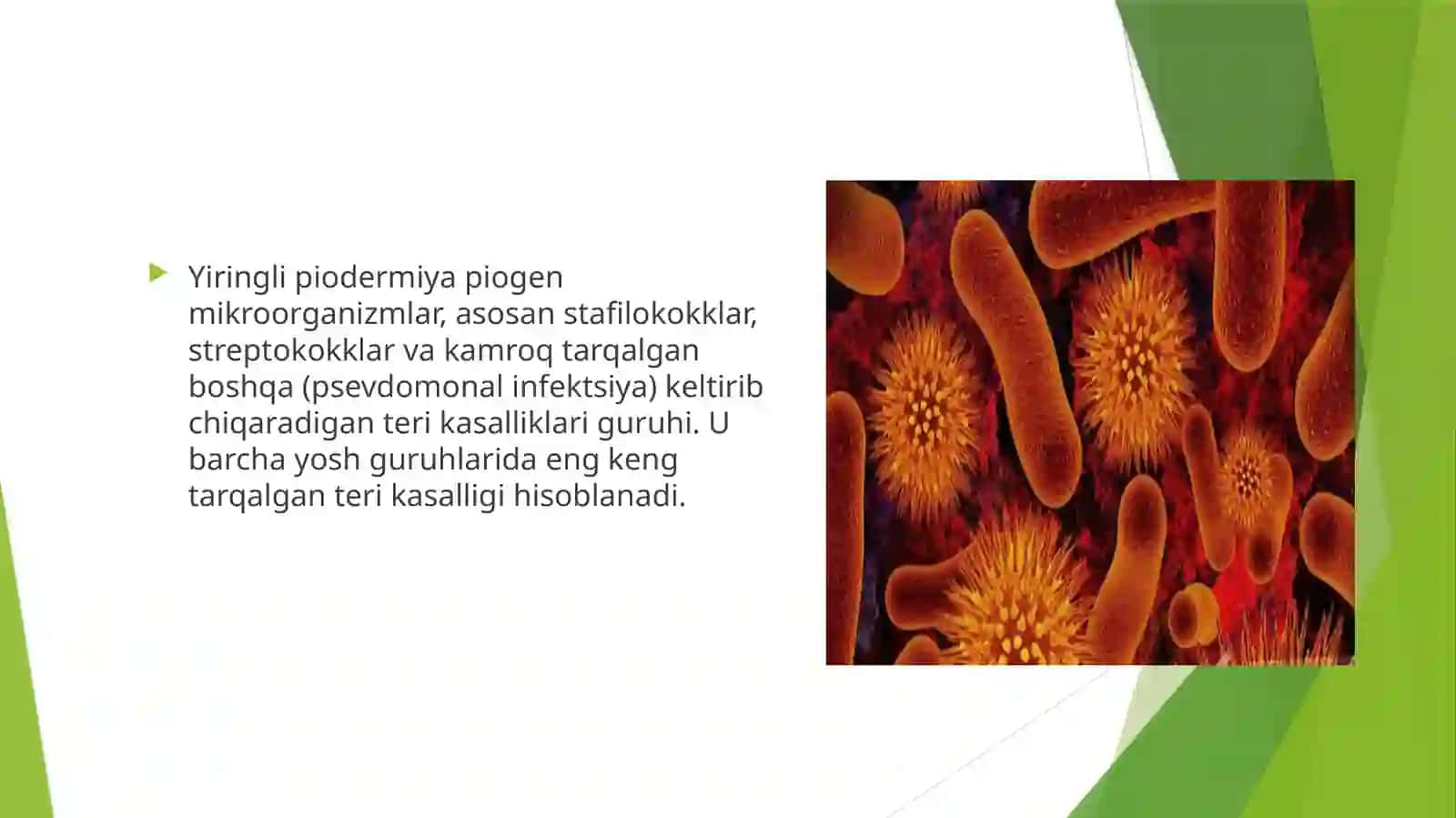 Yiringlipiodermiyasi 2