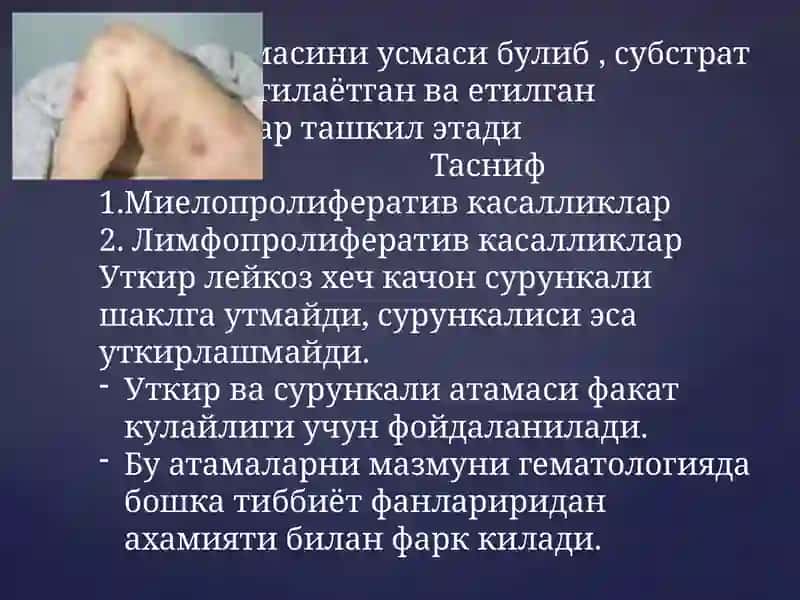 Сурункали  лейкозлар 2