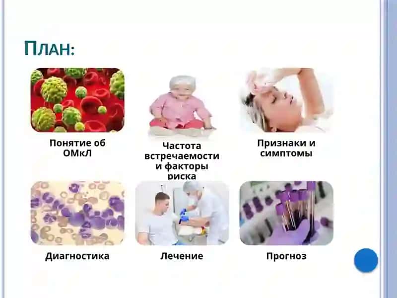 Острый мегакариоцитарный лейкоз 2
