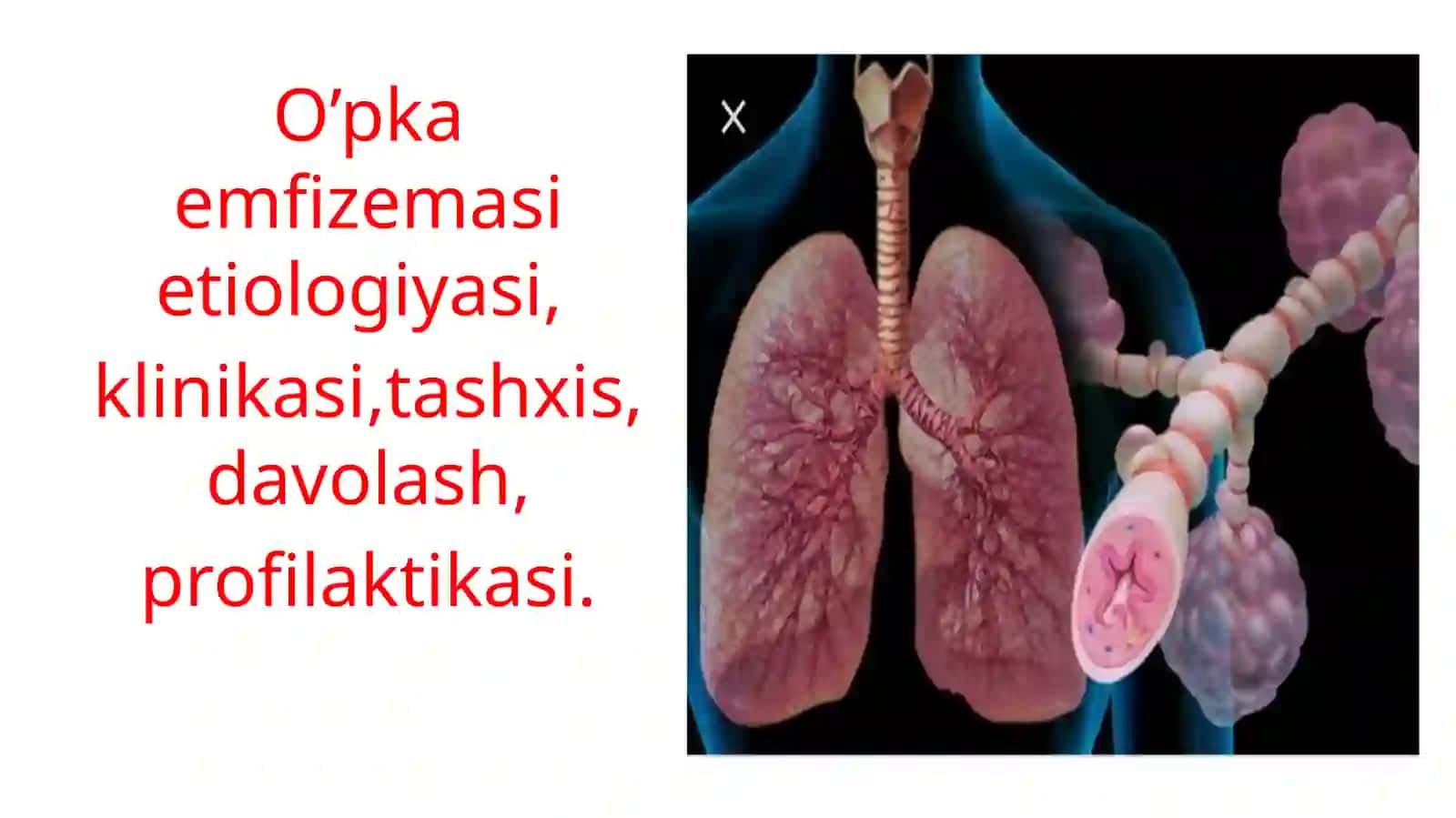 O’PKA EMFIZEMASI 2