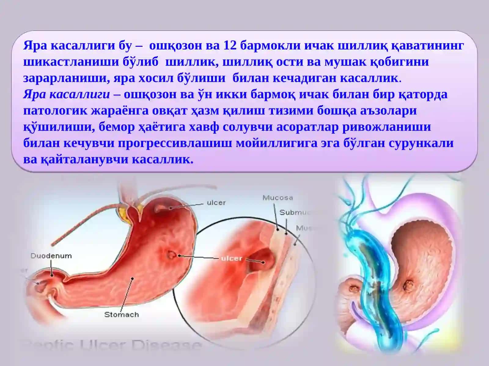 Яра касаллиги 2