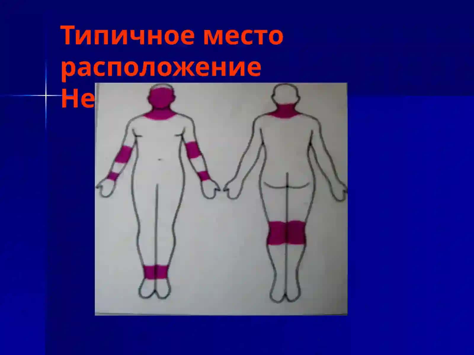 Кожные и венерические заболевания 2