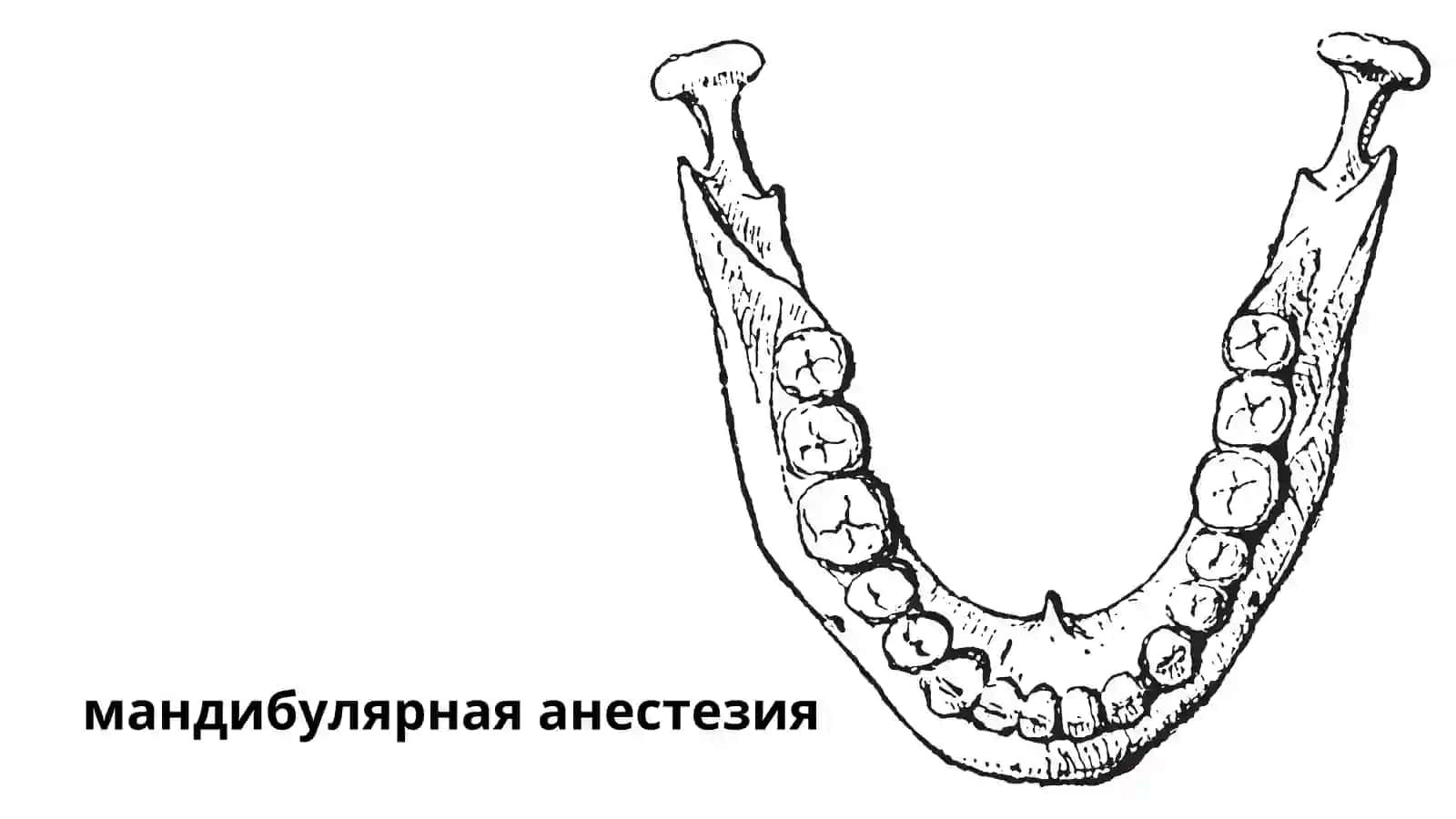 Мандибуляр анестезия 2