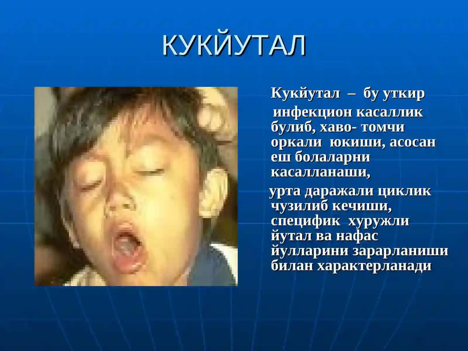Кукйутал, эпидемик паротит 2