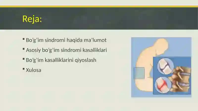Bo‘g‘im sindromi 2
