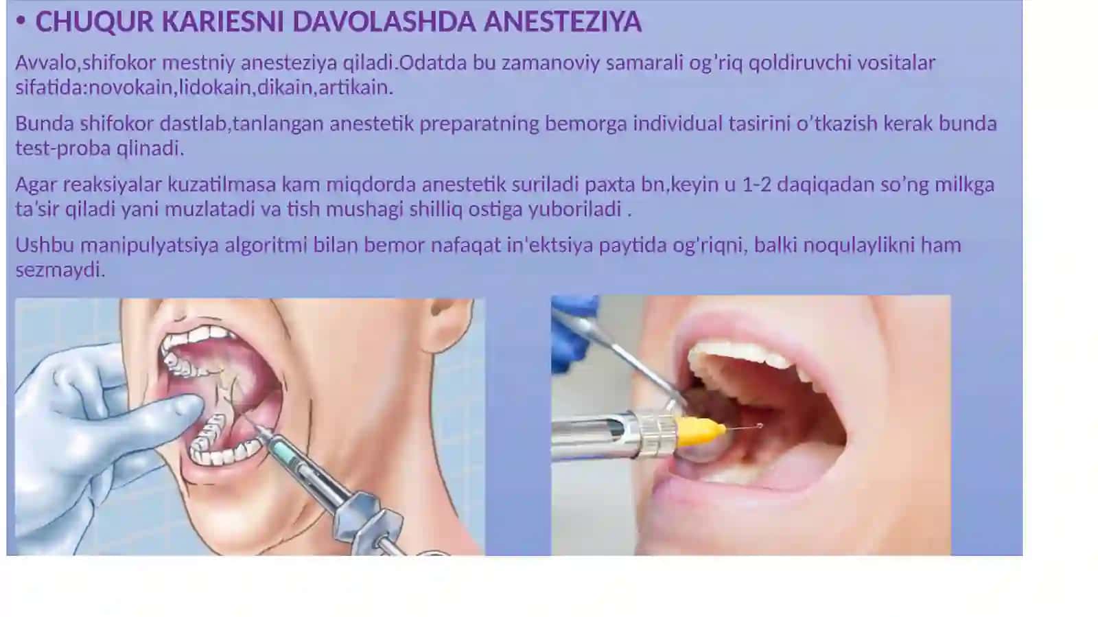 CHUQUR KARIESNI DAVOLASH 2