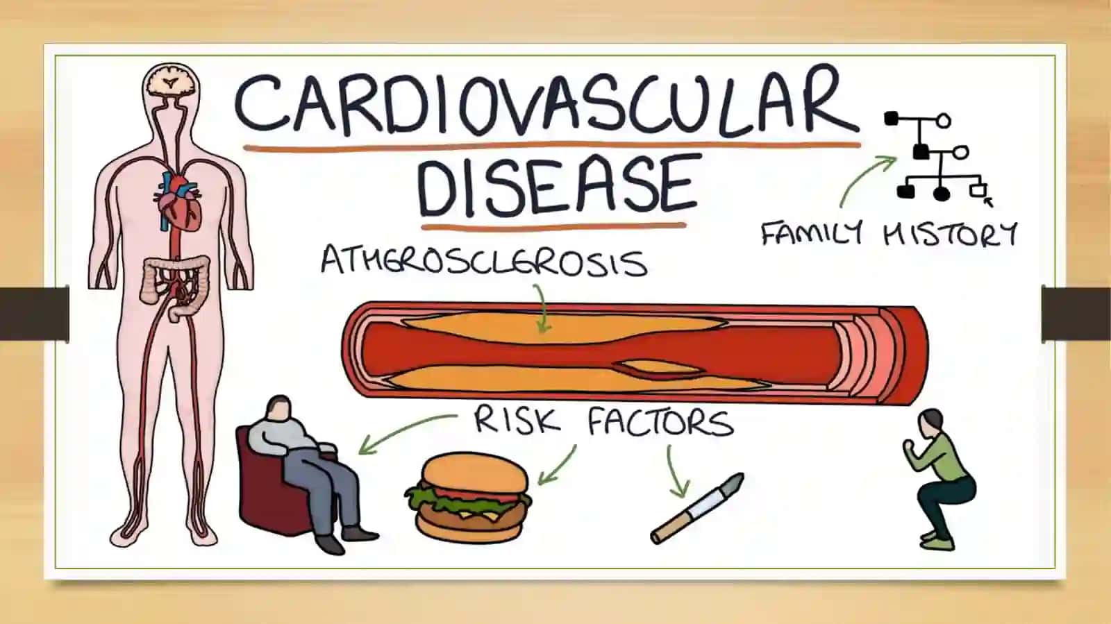 Heart anda vascular system 2