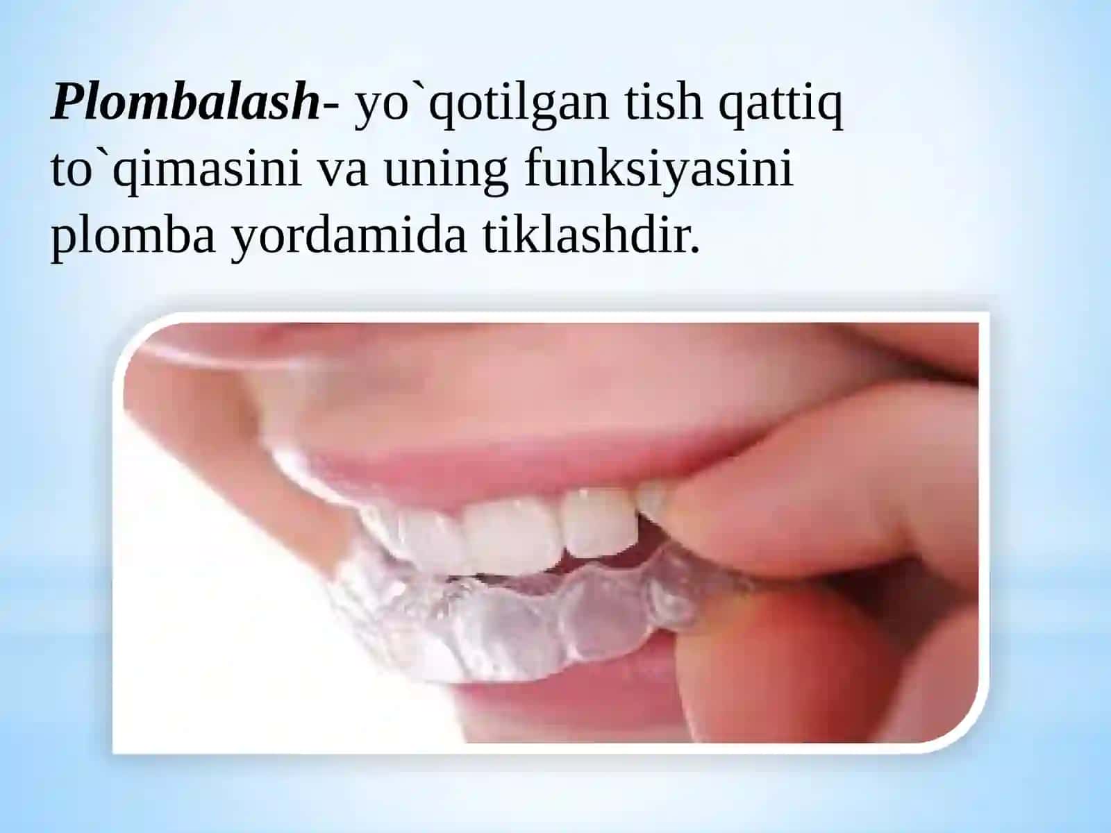 Zamonaviy Kompozit plomba ashyolari 2
