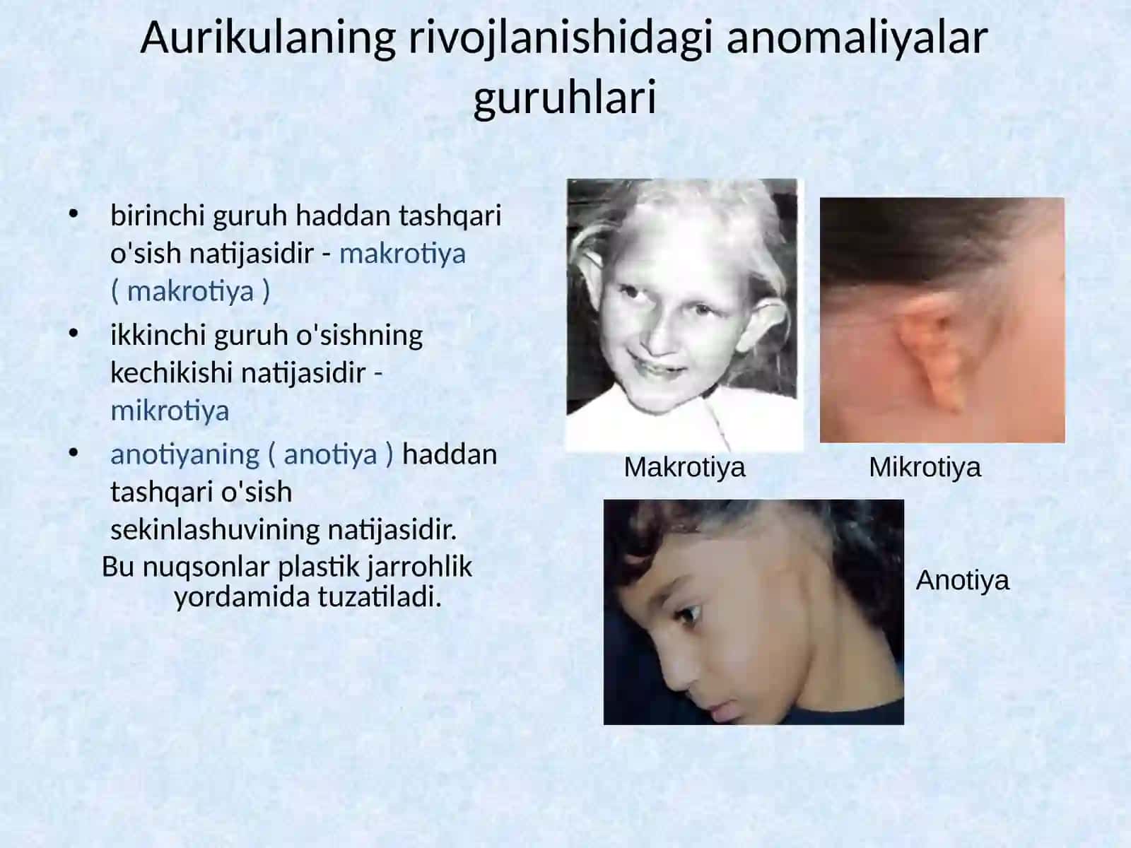 Tug'ma quloq anomaliyalari 2