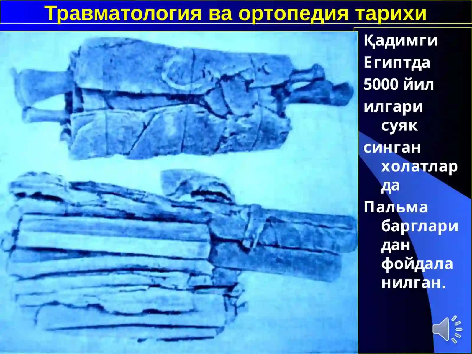 Травматология ва ортопедия 2
