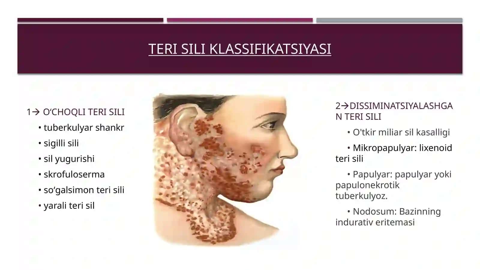 Teri sili 2