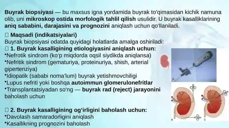 Buyrak biopsiyasi pptx 2