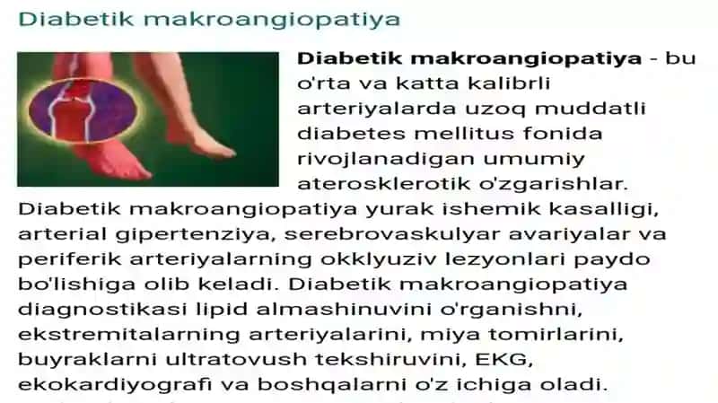 Diabetik  makroangiopatiyalar 2