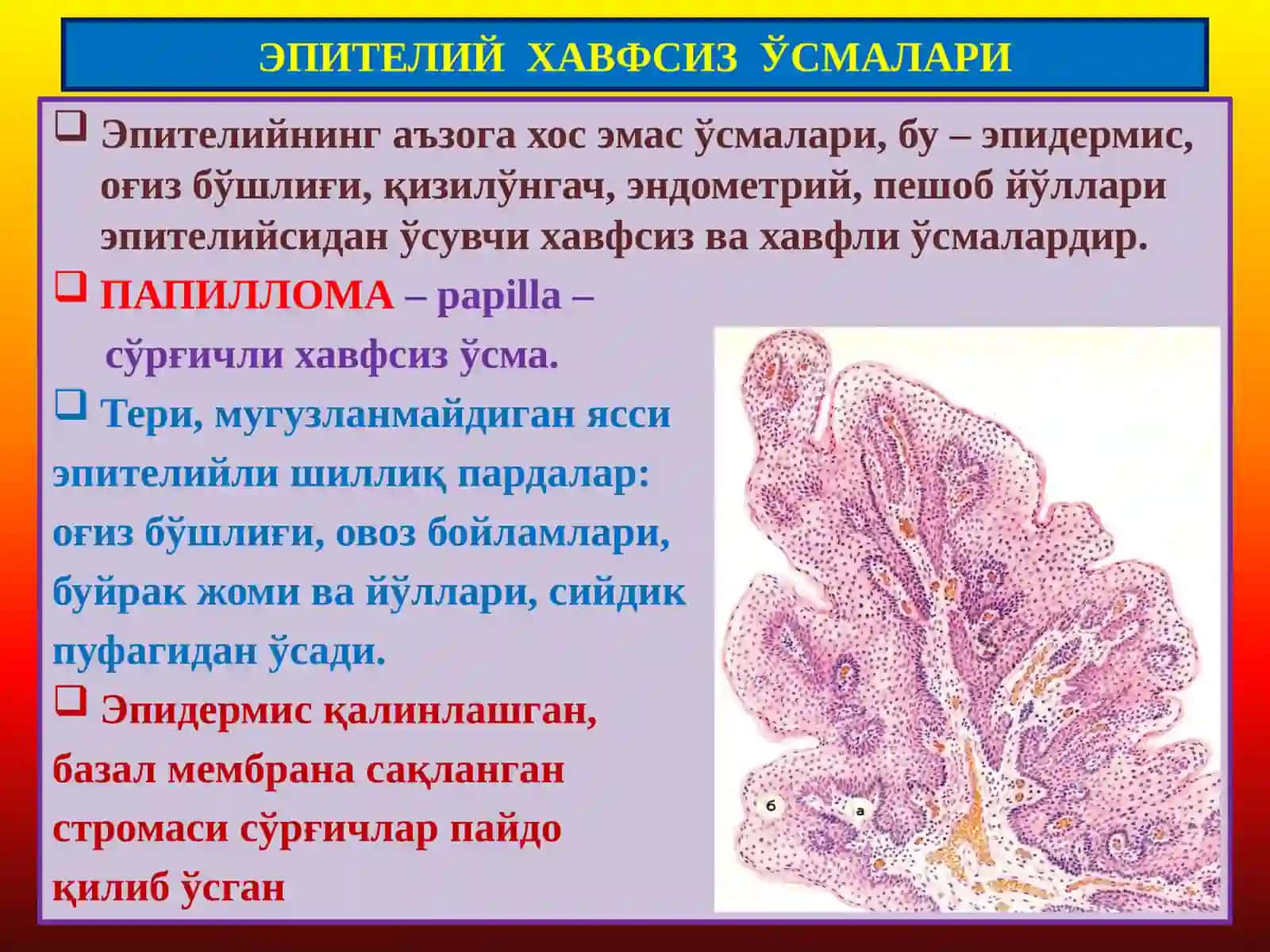 Ўсмалар. Мезенхимал ўсмалар 2