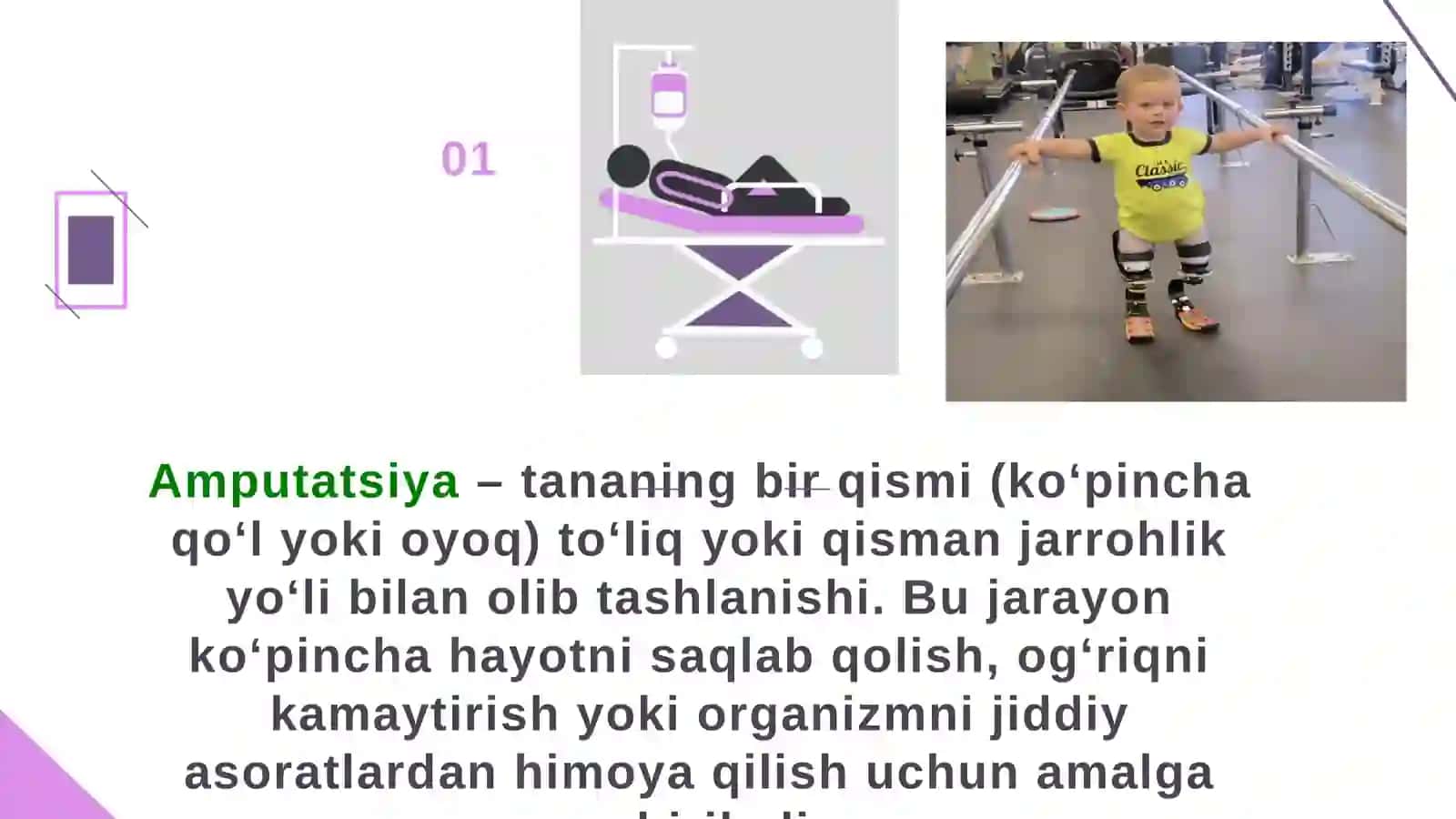 Bolalarda amputatsiya xususiyatlari 2