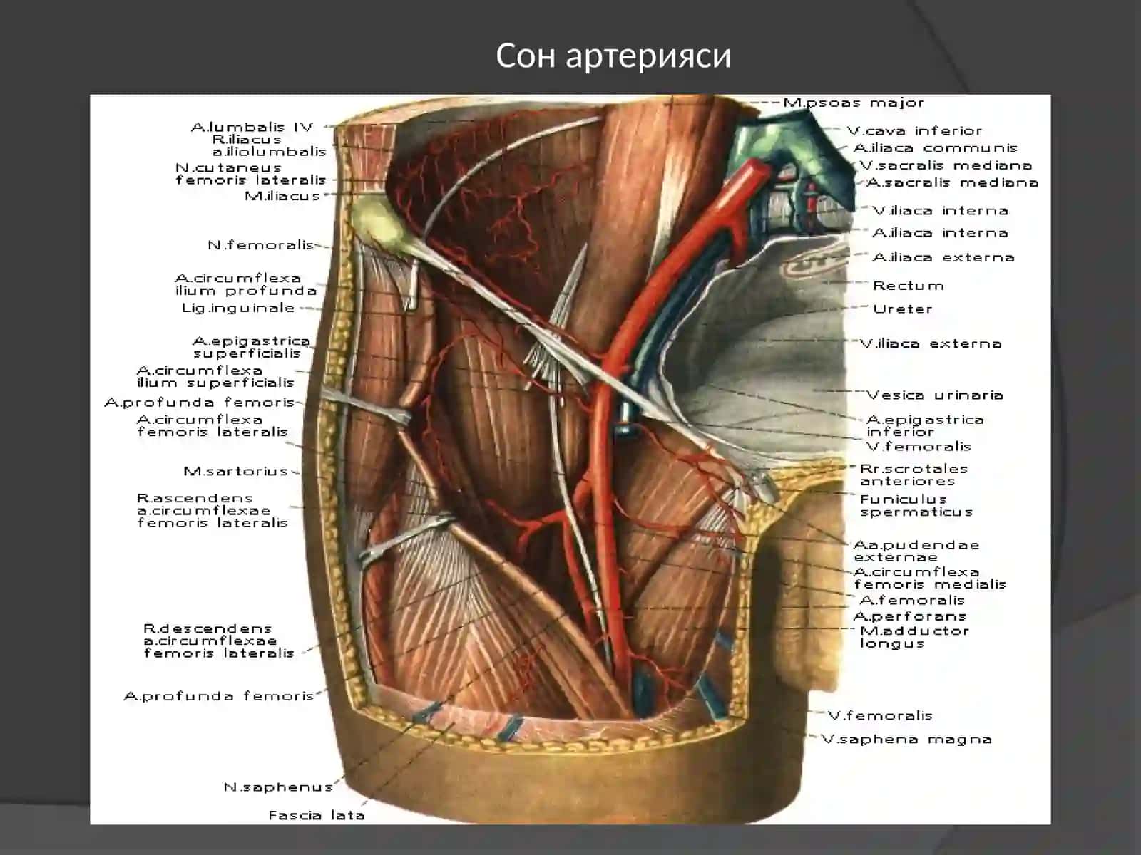 Сон артерияси 2