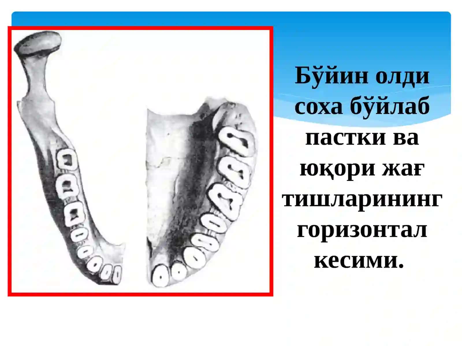 Тишлар морфологияси 2