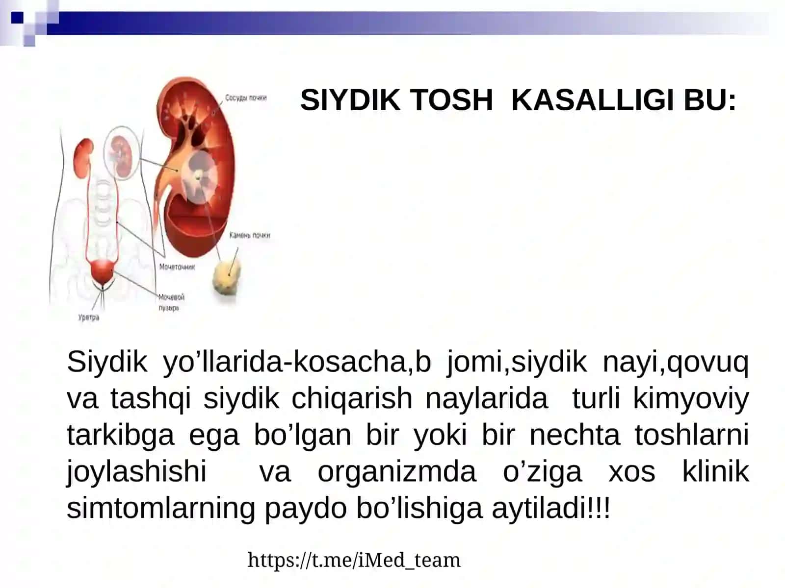 SIYDIK TOSH KASALLIGI 2