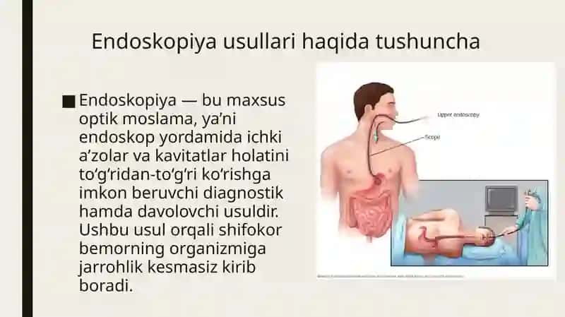 Tibbiyotda endoskopik usullarning qoʻllanishi 2