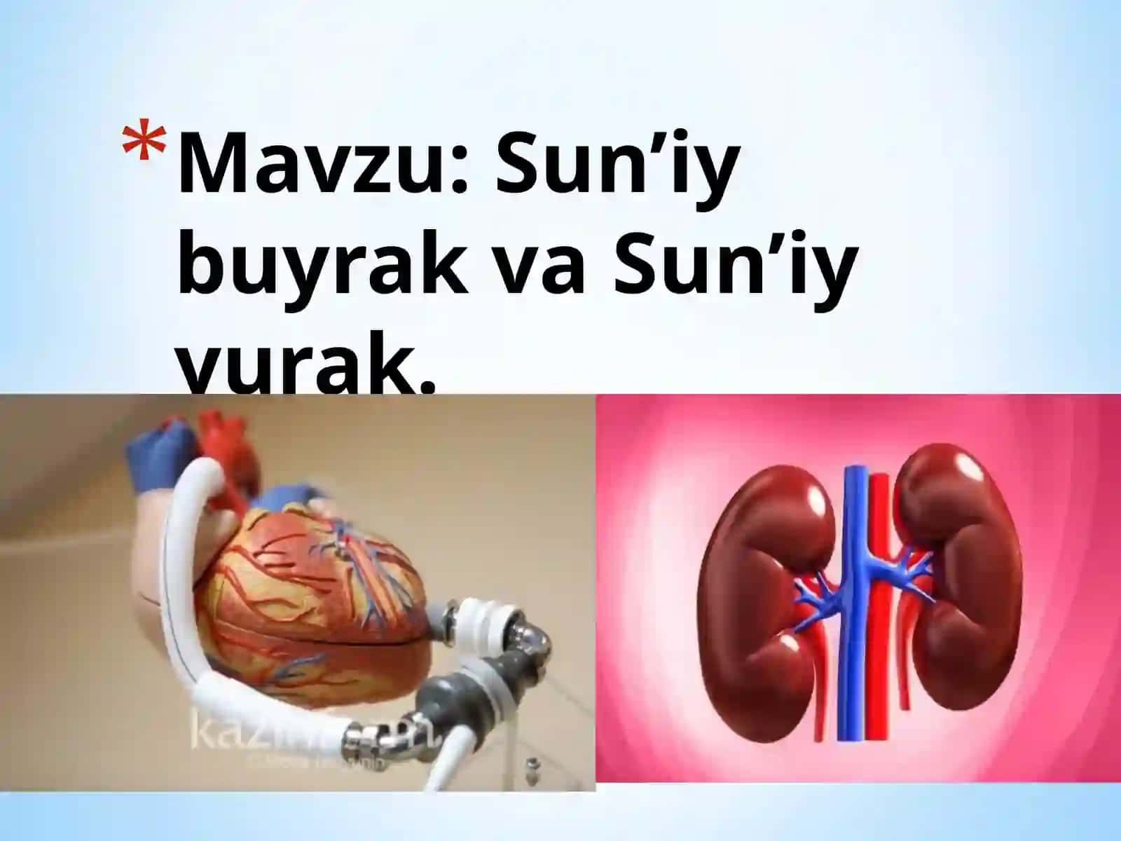 Sun'iy Buyrak va Sun'iy Yurak 2