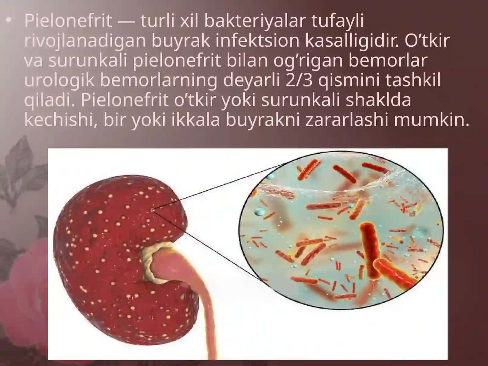 O`tkir va surunkali pielonefrit 2