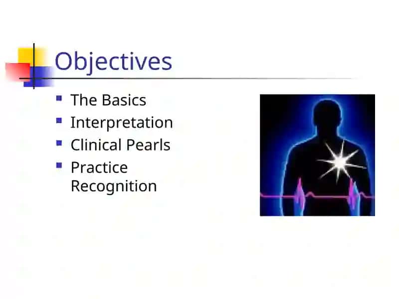 EKG Interpretation 2