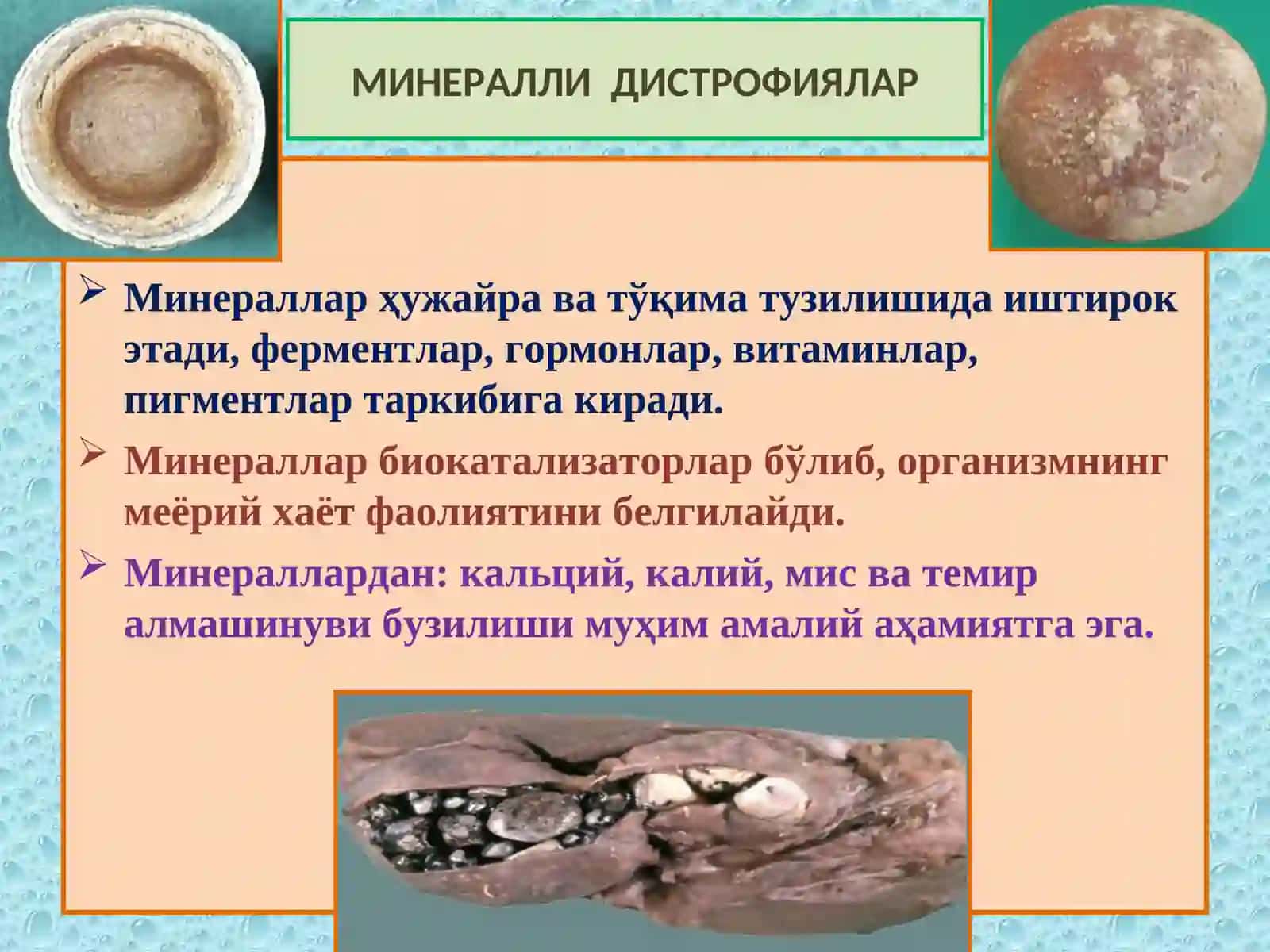 Минарал дистрофия. Некроз 2