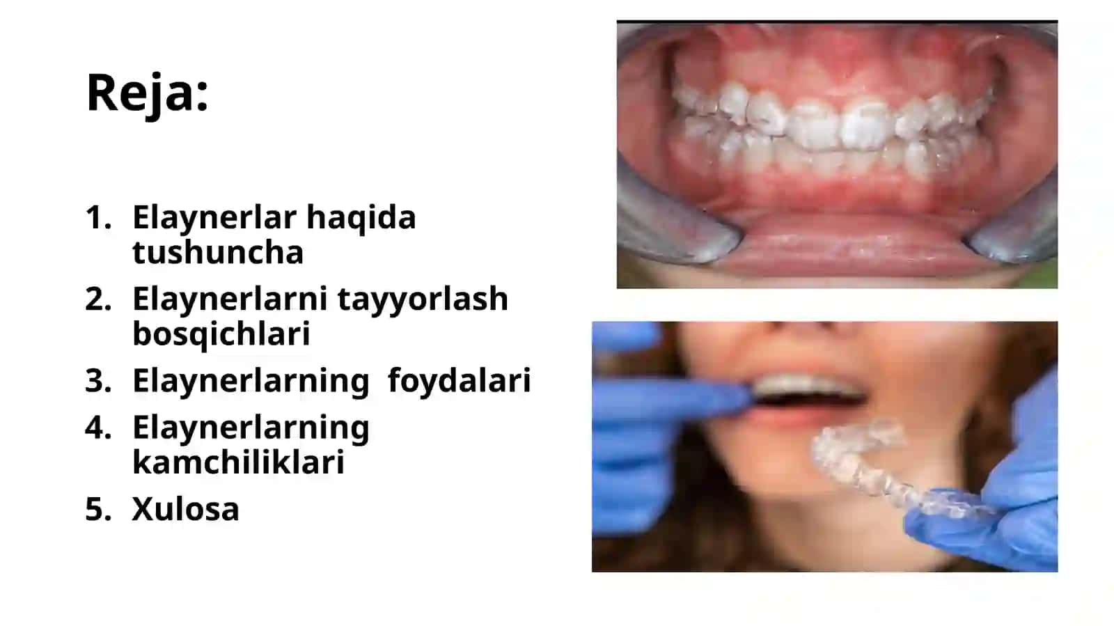 Elaynerlar 2