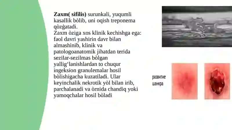 ZAXM 2