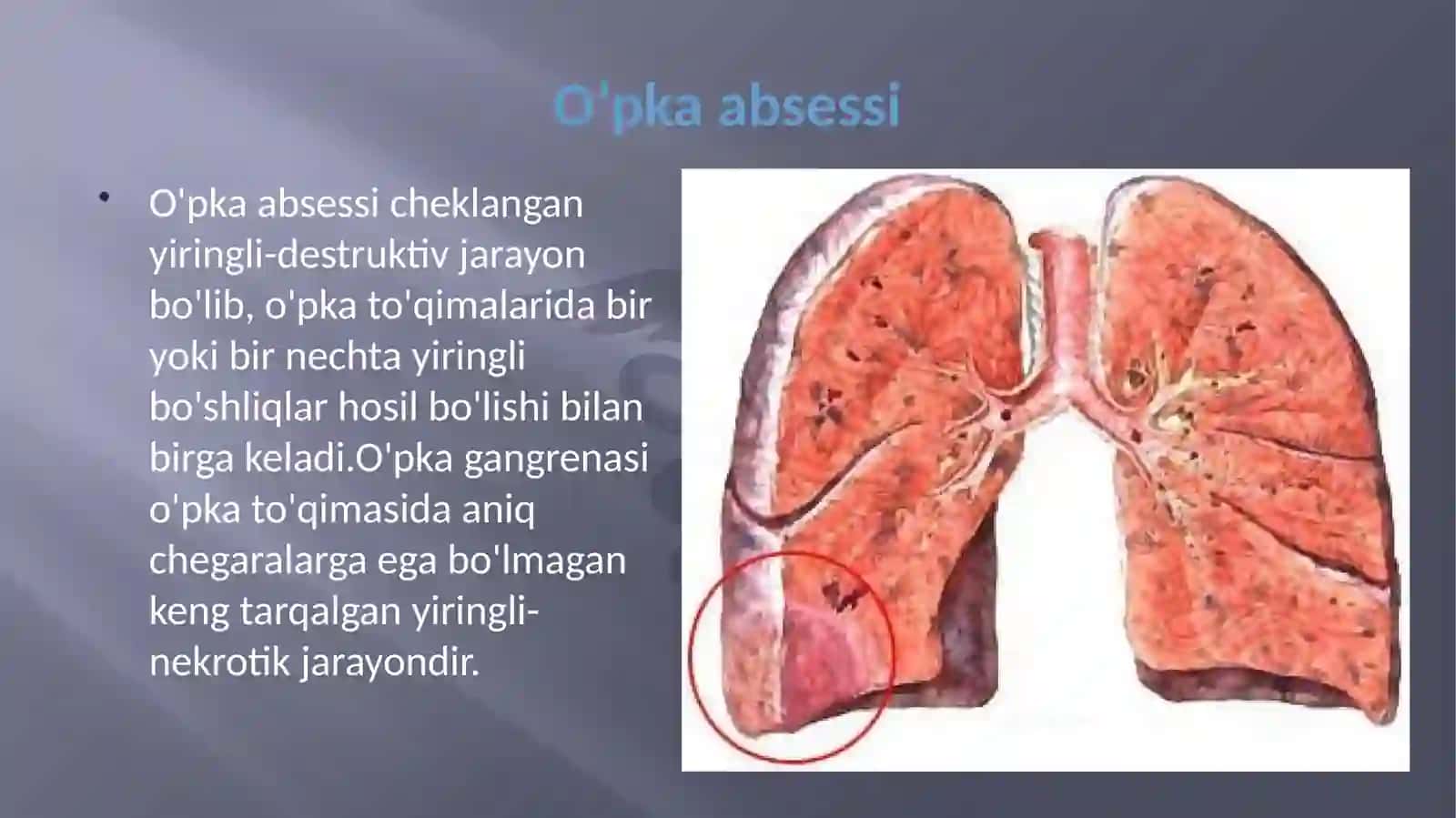 O`PKA ABSESSI 2