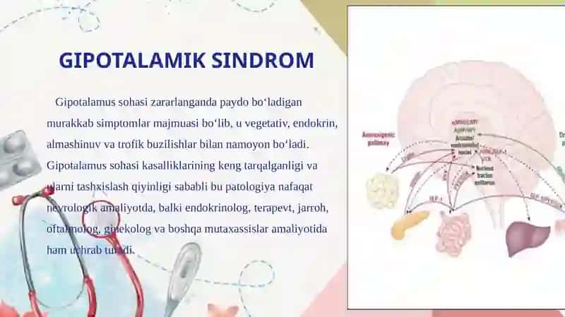 Gipotalamik sindrom 2