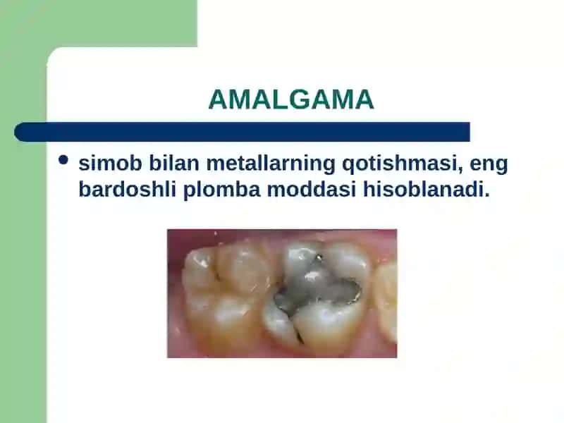 Amalgamalar turlari 2