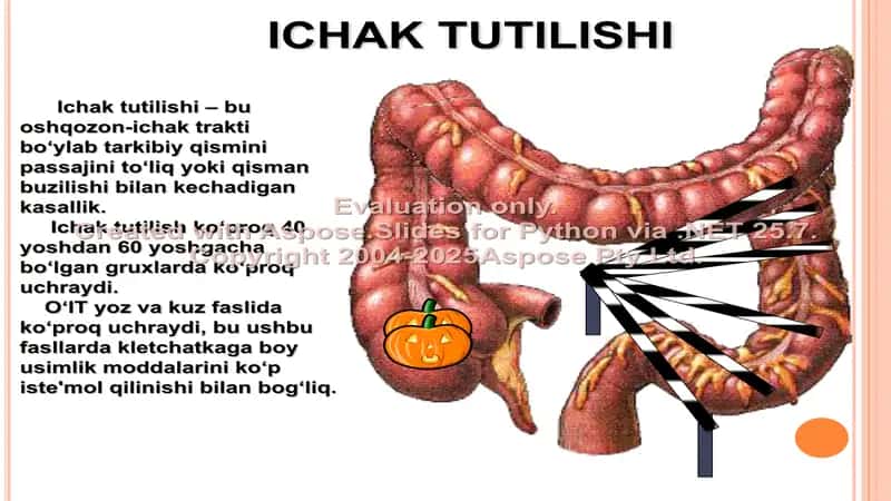 Ichak tutilishi 2