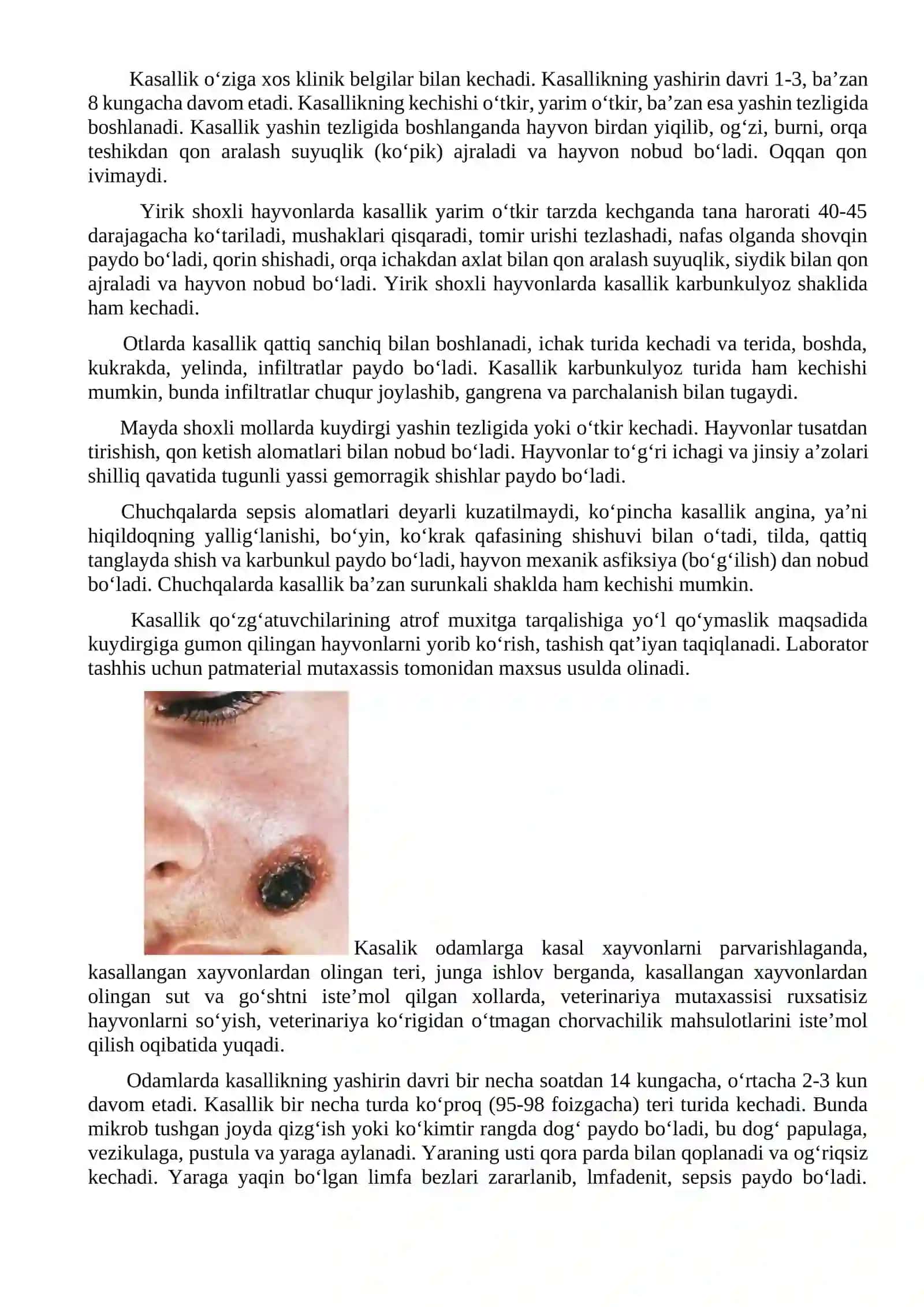 Kuydirgi kasalligi va uning profilaktikasi 2