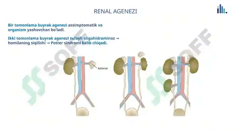 Renal Panalogiya 2