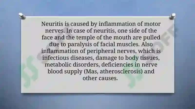 Neuritis 2