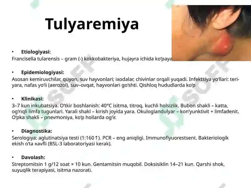 Tulyaremiya imfiksiya 2