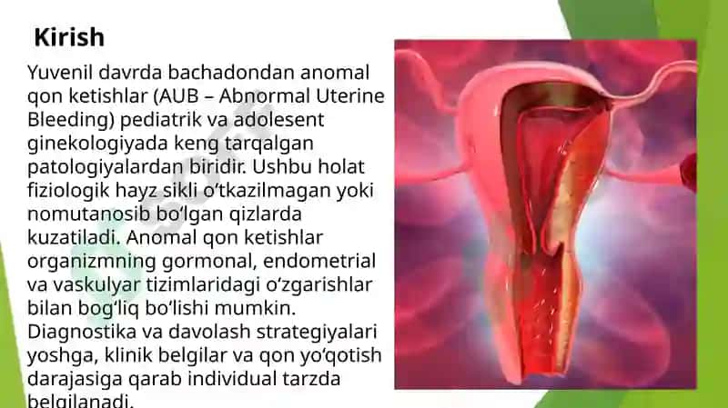 Yuvenil davrda bachadondan anomal qon ketishlar 2