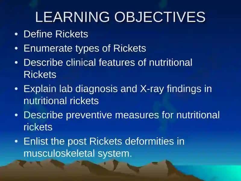 Rickets 2