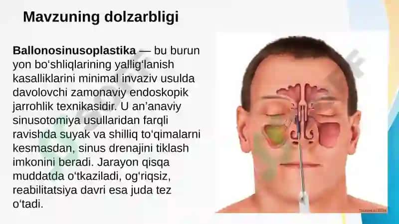 Ballonosinusoplastika 2