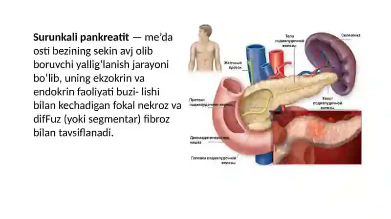 Surunkali Pankreatit 2