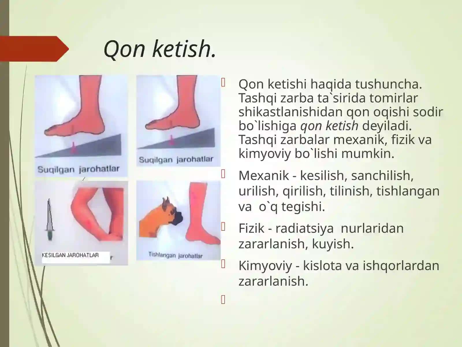 Qon ketish 2