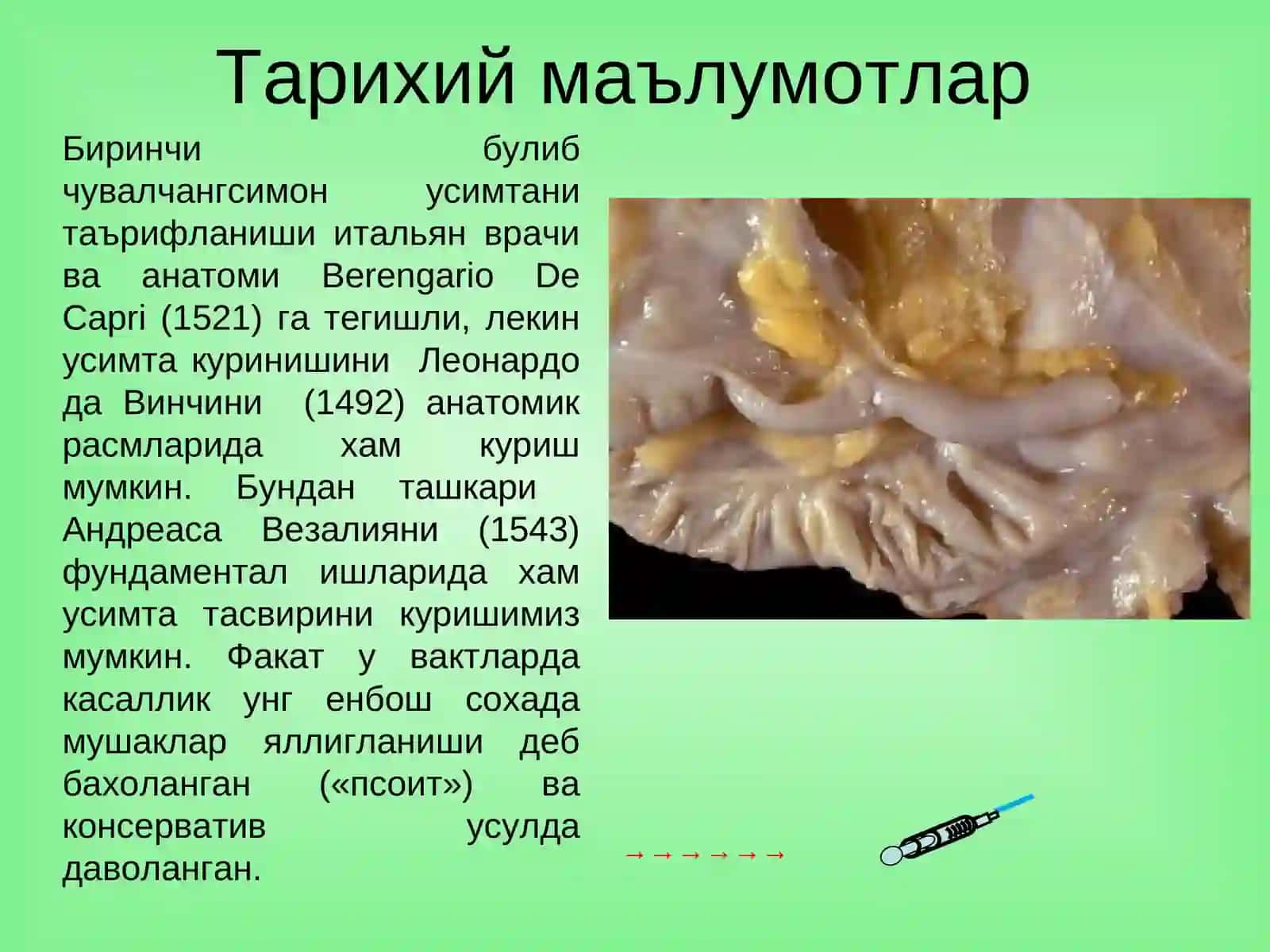 Ўткир аппендицит ва унинг асоратлари 2
