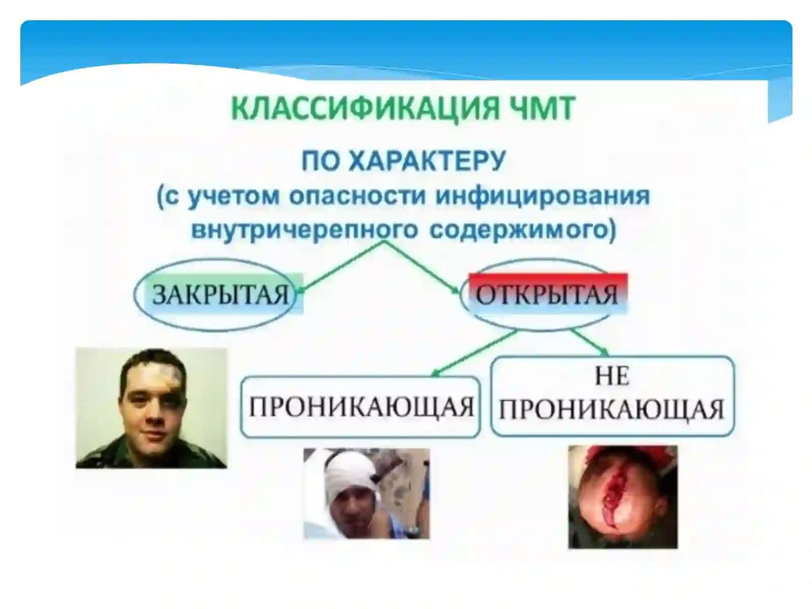 Bosh miya travmalari.Radiologik ko'rinishlar 2