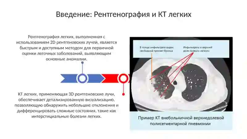 Рентгени КТлегких 3
