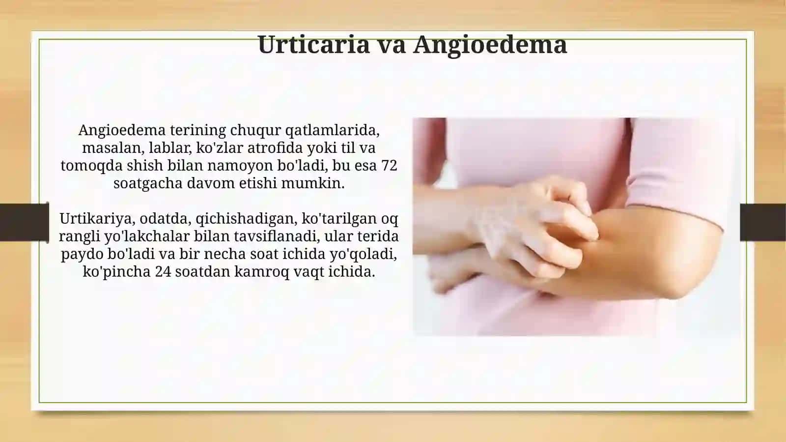 Terining allergik kasalliklari 3