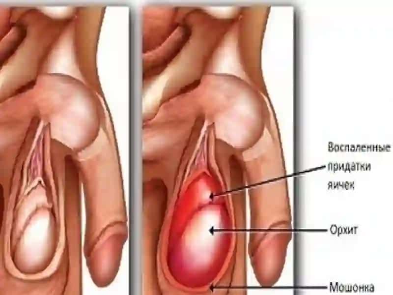 Орхит 3