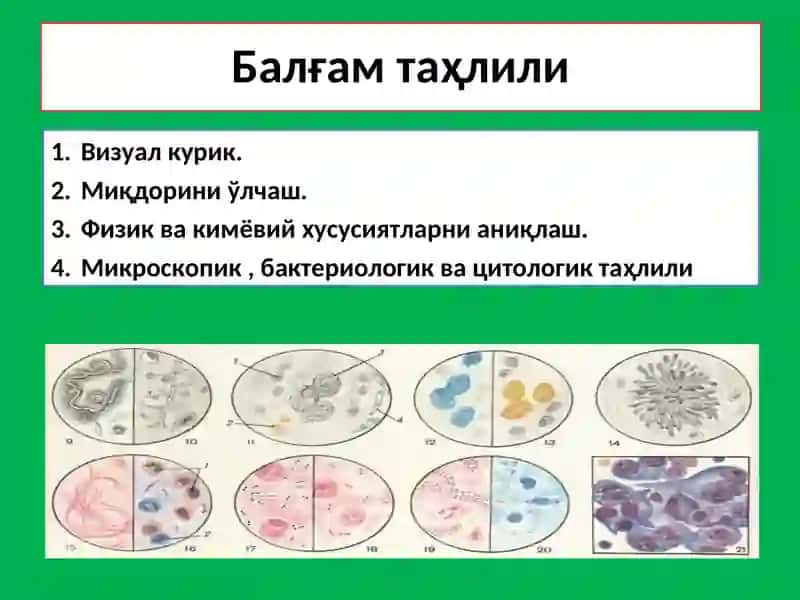Балғам таҳлили 3