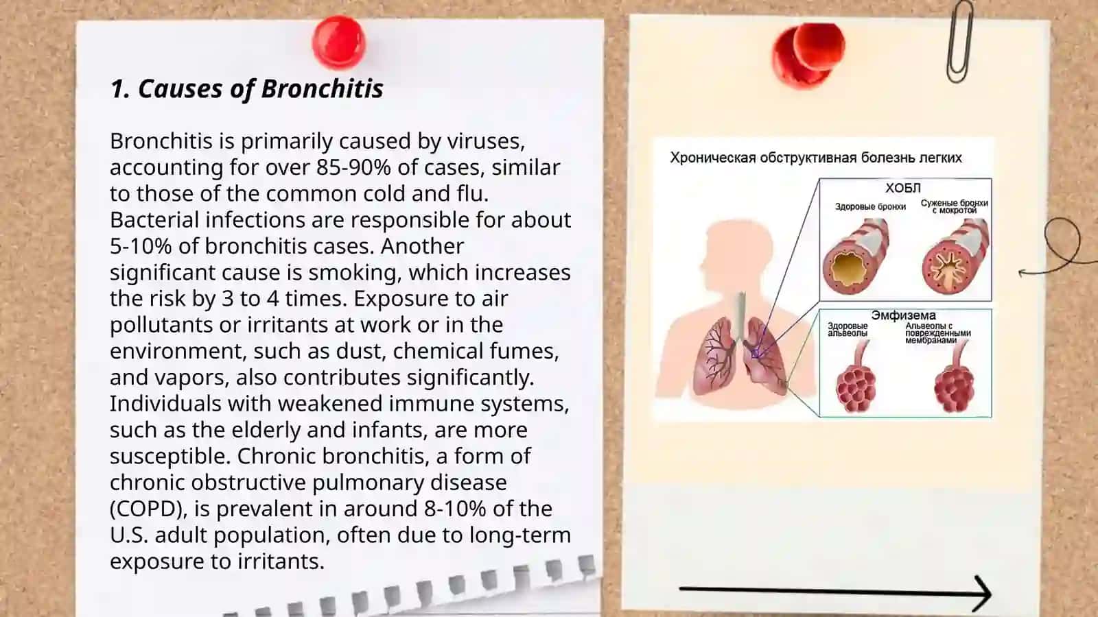 Bronchitis 3