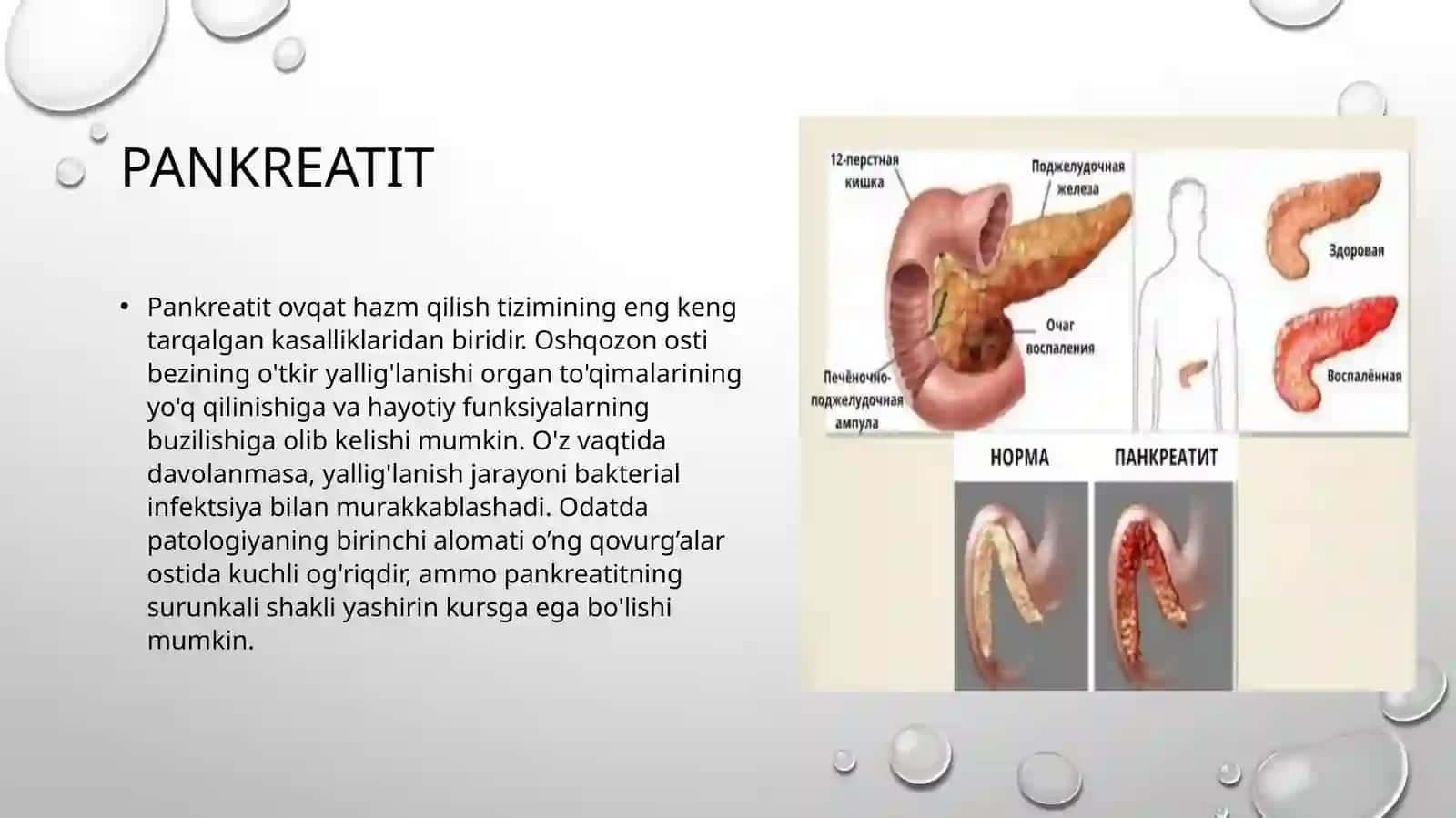 Pankreatit rivojlanishining biokimyoviy asoslari, davolash va diagnostika tamoyillari, ingichka ichakda parchalanish mahsulotlari so'rilishining buzilishi (seliakiya), kronk kasalligi va yarali kolit rivojlanishining biokimyoviy asoslari 3